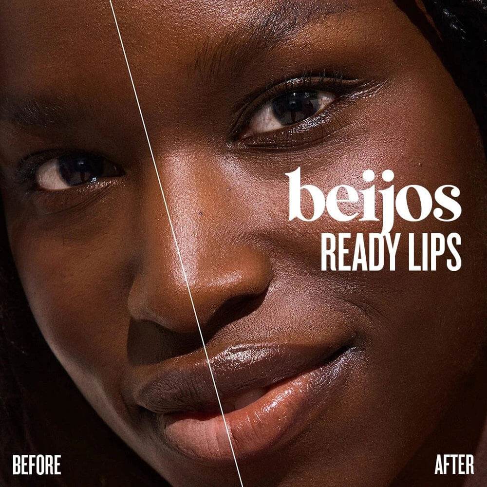 Before and after comparison of a woman's lips with 'beijos READY LIPS' text.