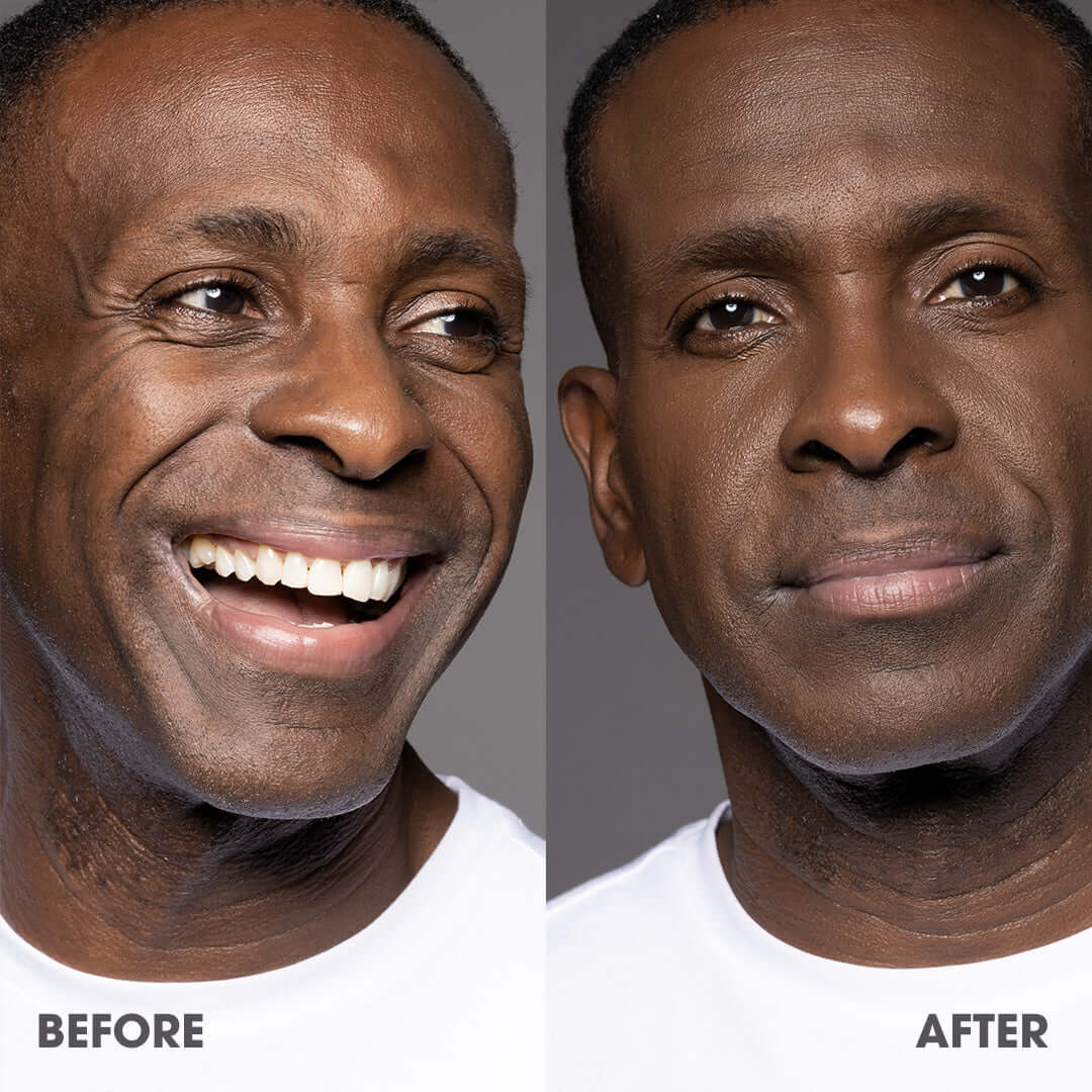 Before and after comparison of a man with dental work on a gray background