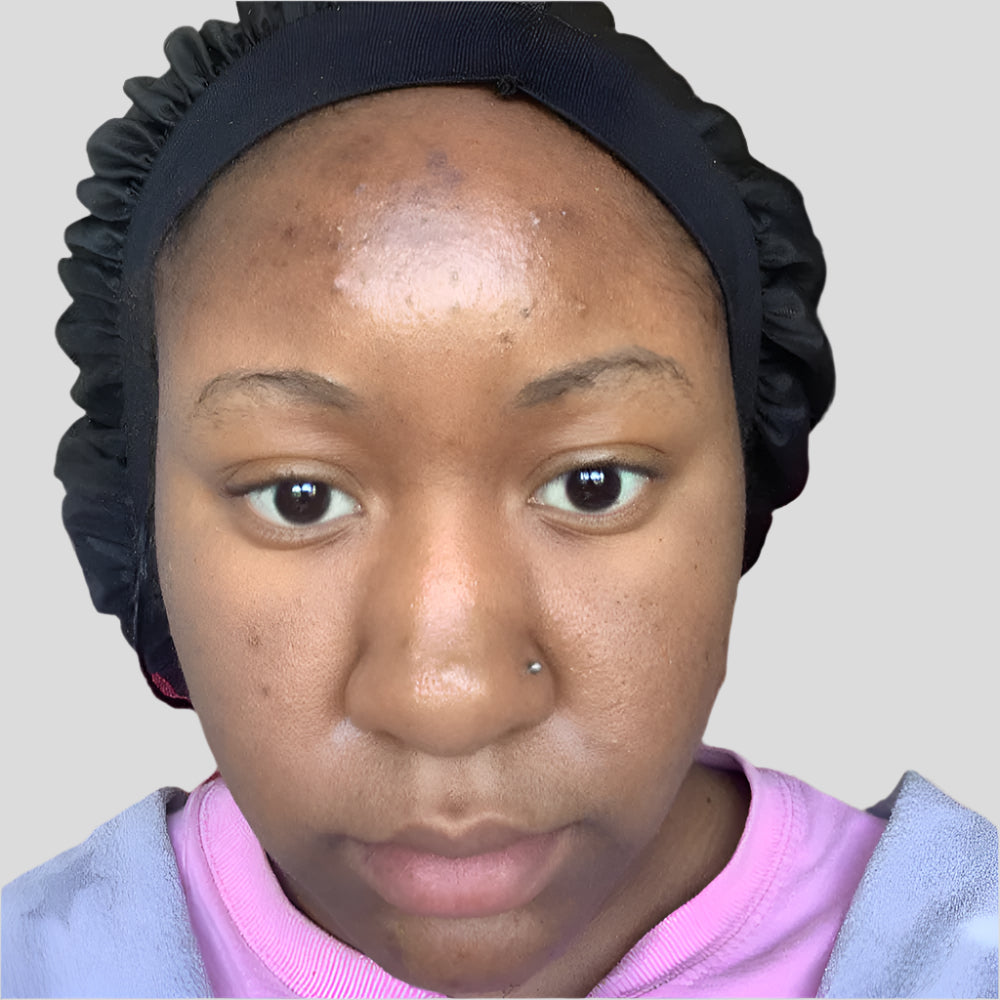 Person wearing a black bonnet indoors showing skincare results