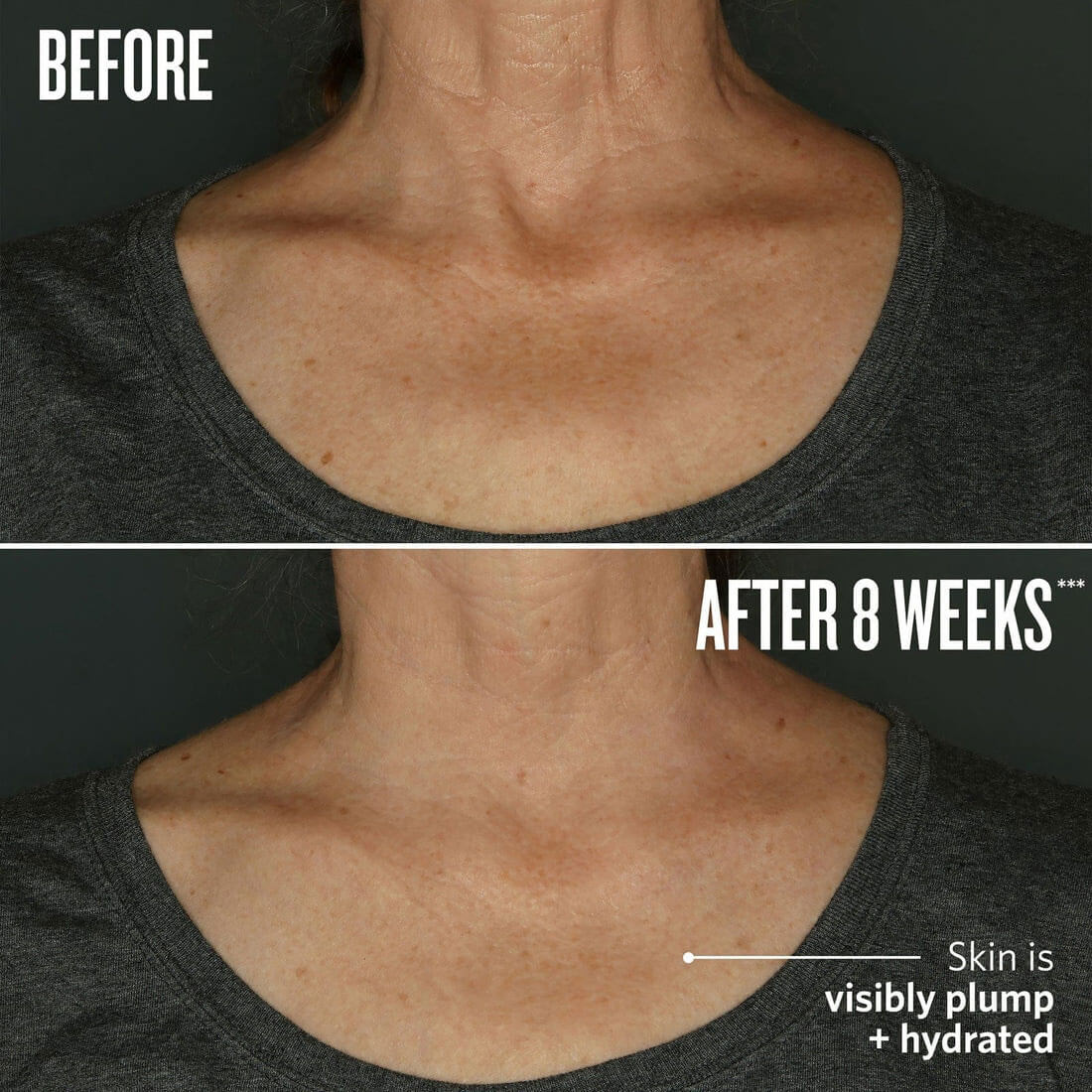 Before and after comparison of neck skin texture with text indicating improvement after 8 weeks.