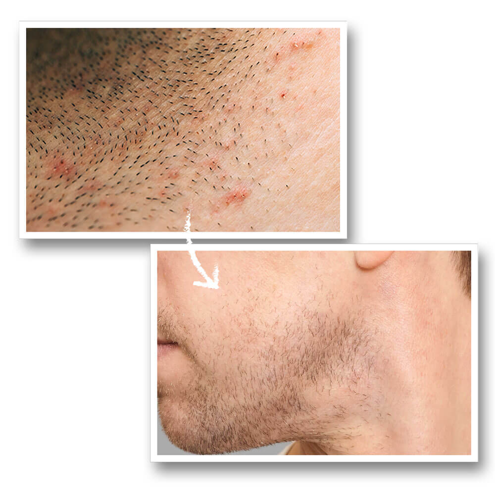 Shakeup Cosmetics Calm As You Are Soothing Post-Shave Lotion