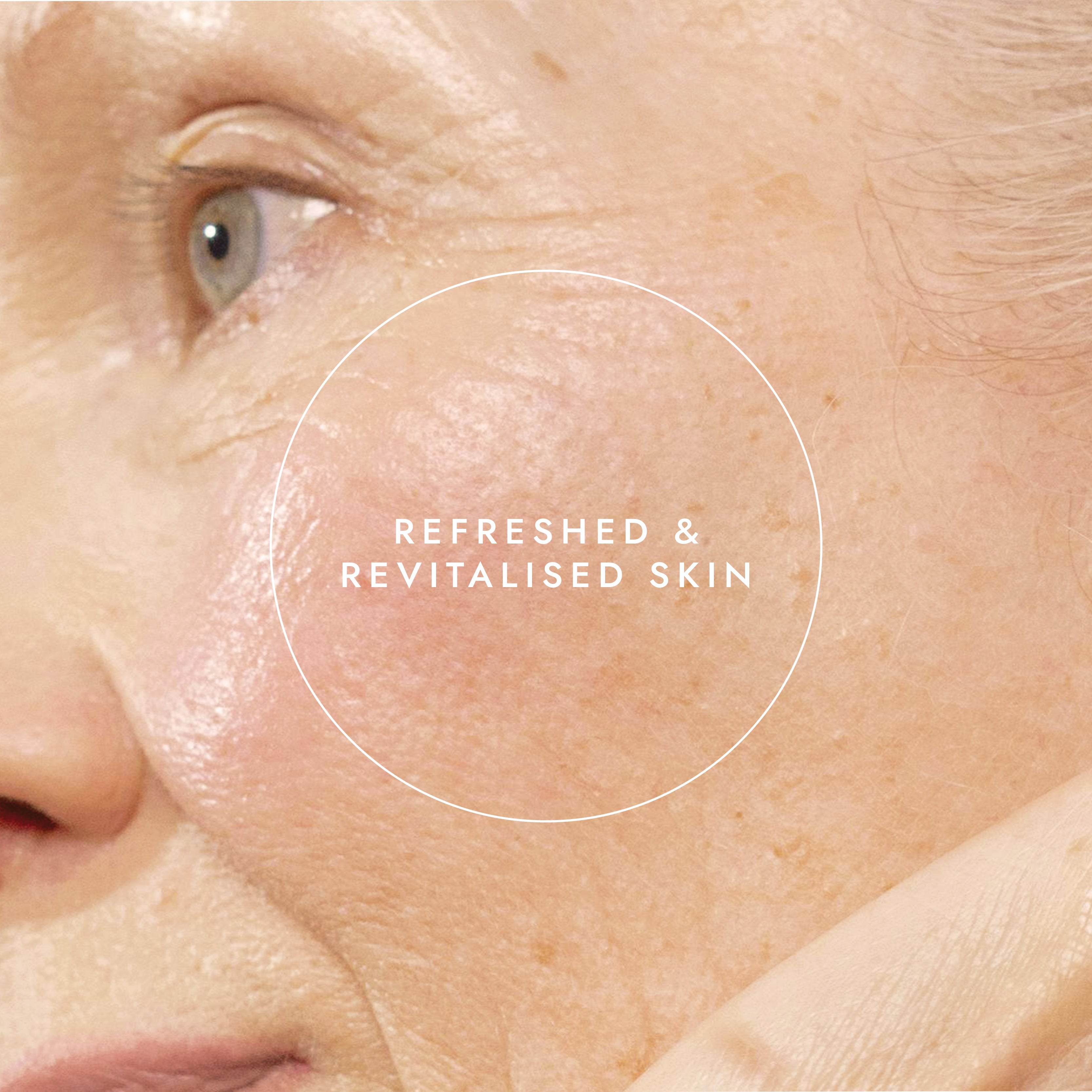 Close-up of a person's face with text 'Refreshed & Revitalised Skin' on a beige background
