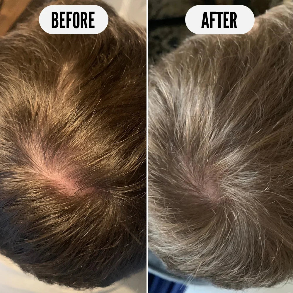 Before and after comparison of hair condition on a person's head.